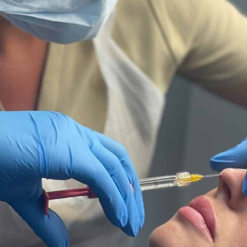 Advanced Dermal Filler (Rhino/Temple/Earlobe)