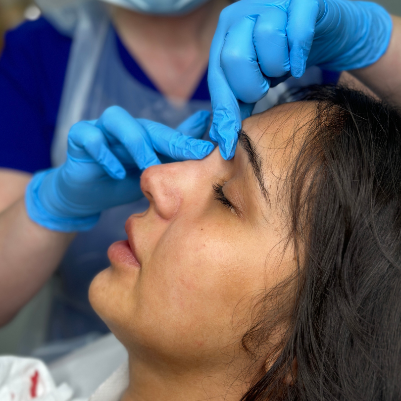 Combine Advanced Dermal filler