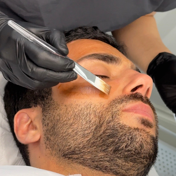 Level 6 Award in Advanced Aesthetic Procedures: Chemical Peels