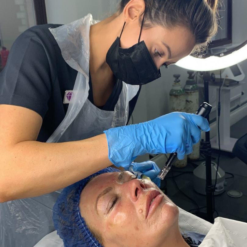 PRP Vampire Facial