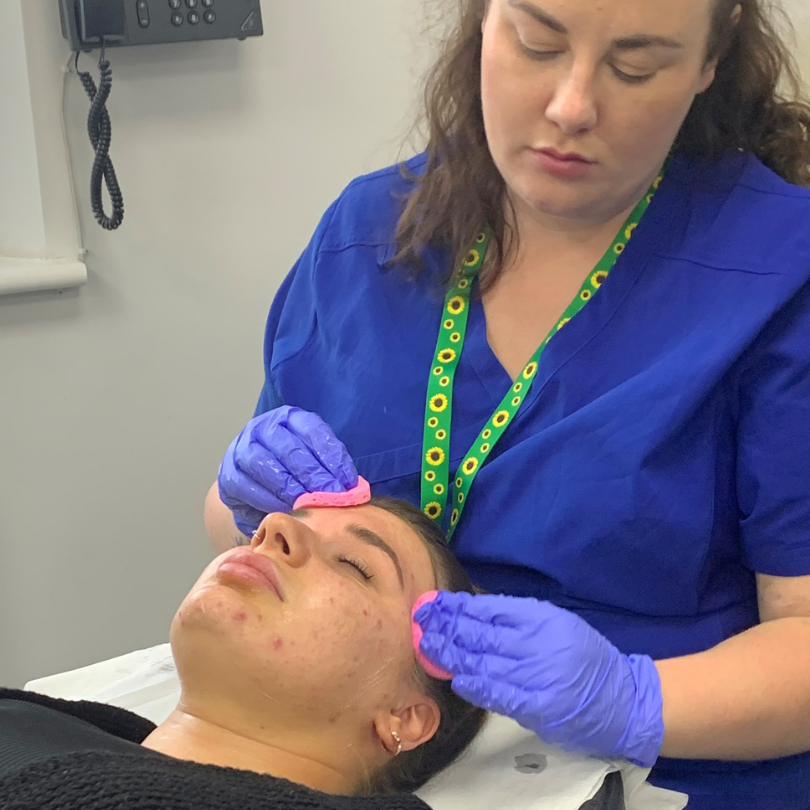 Toskani Chemical Peel