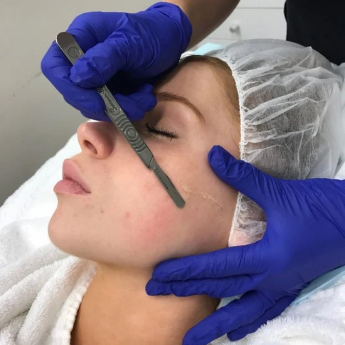 Dermaplaning, Electrotherapy, Microneedling & Chemical Peel
