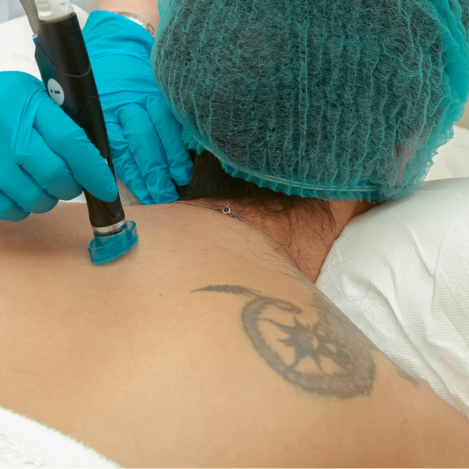 Semi-Permanet Makeup & Laser Specialist